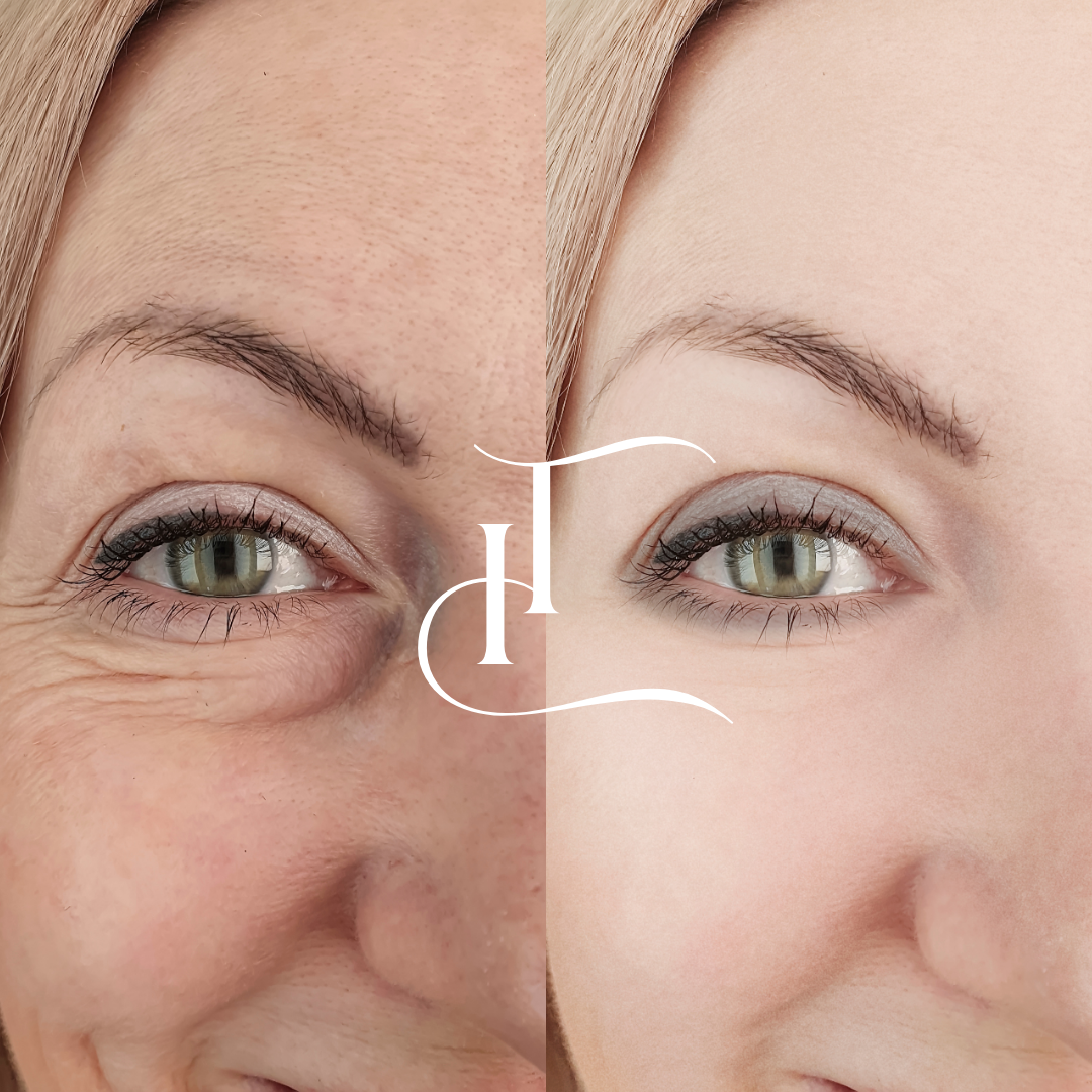Especialista-em-Harmonizacao-Facial-2-1.png